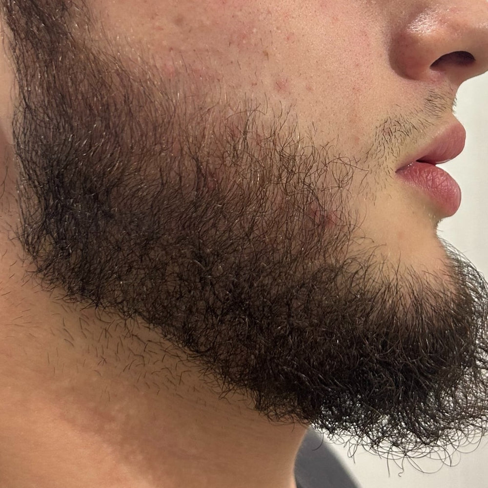 rastezh_na_brada_slider_sled