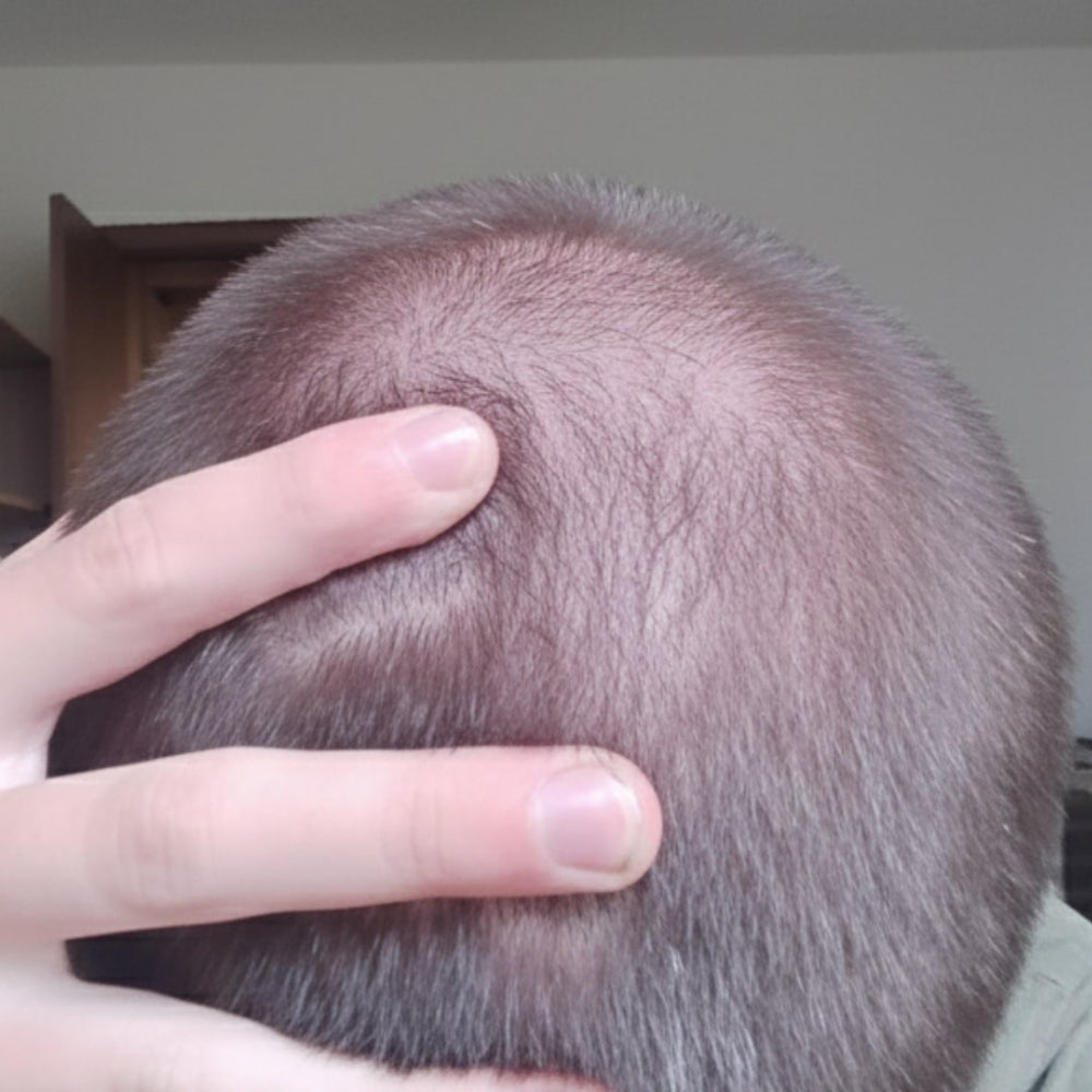 rastezh_na_kosa_predi3