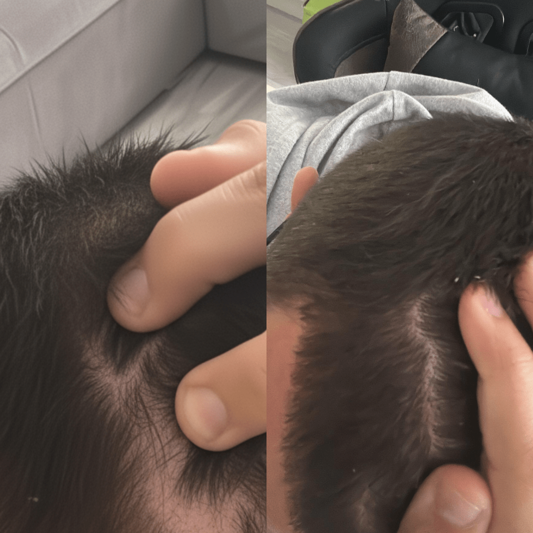 rastezh_na_kosa_transformacia6