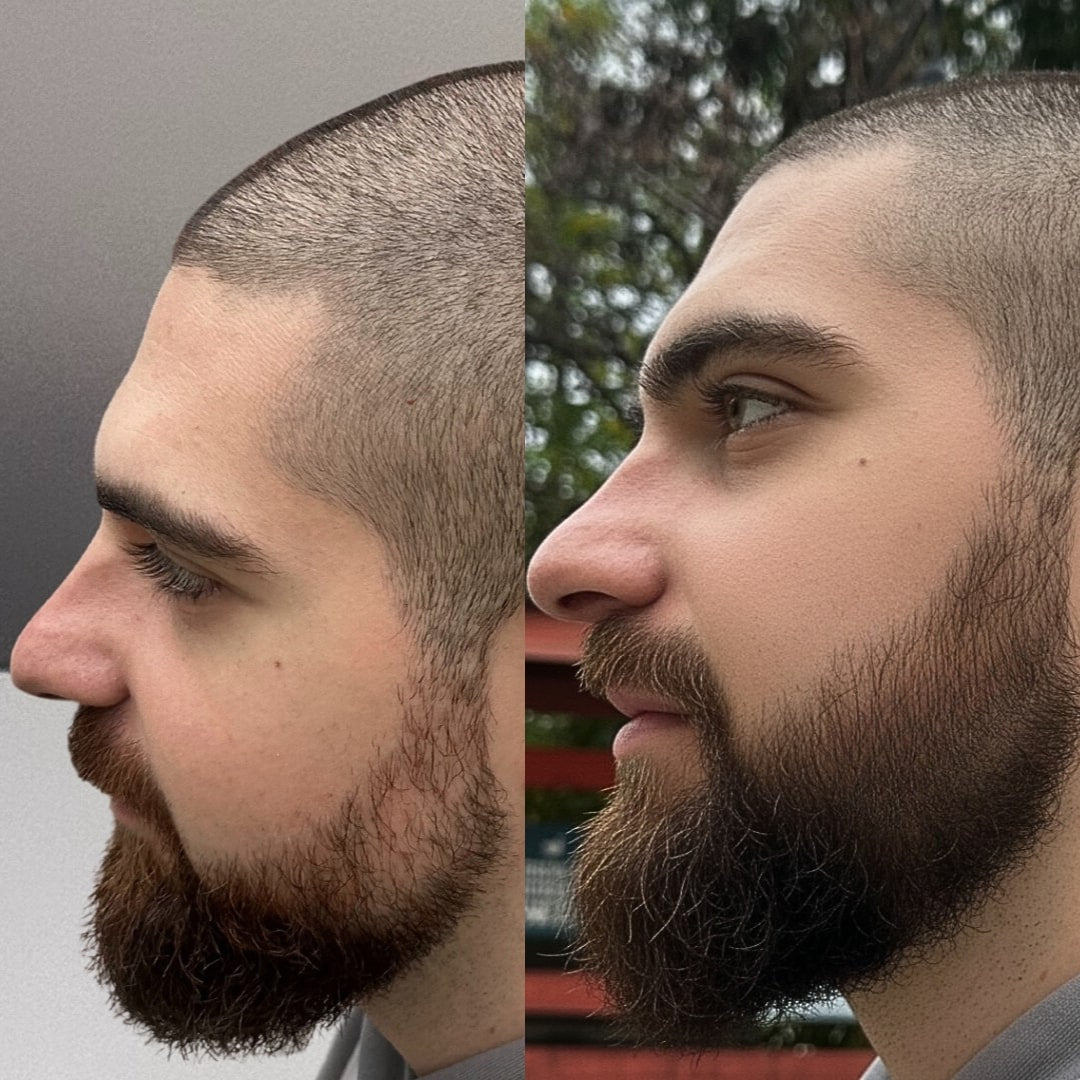 transformaciya2_rastezh_na_brada_predi_sled