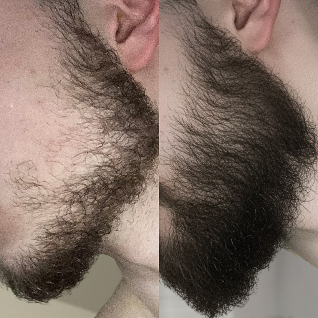 transformaciya3_rastezh_na_brada_predi_sled