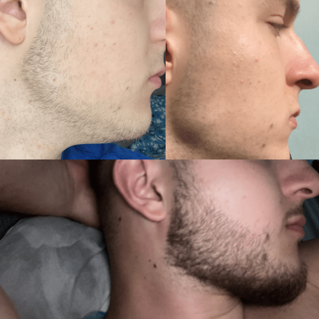 transformation_beard_before_after_ivan2